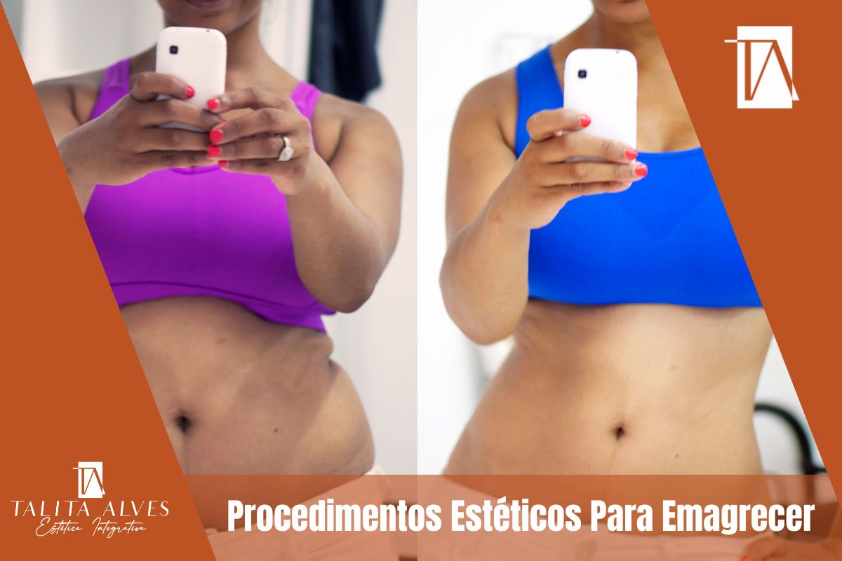 Emagrecer Perder Barriga Procedimentos Estéticos SP