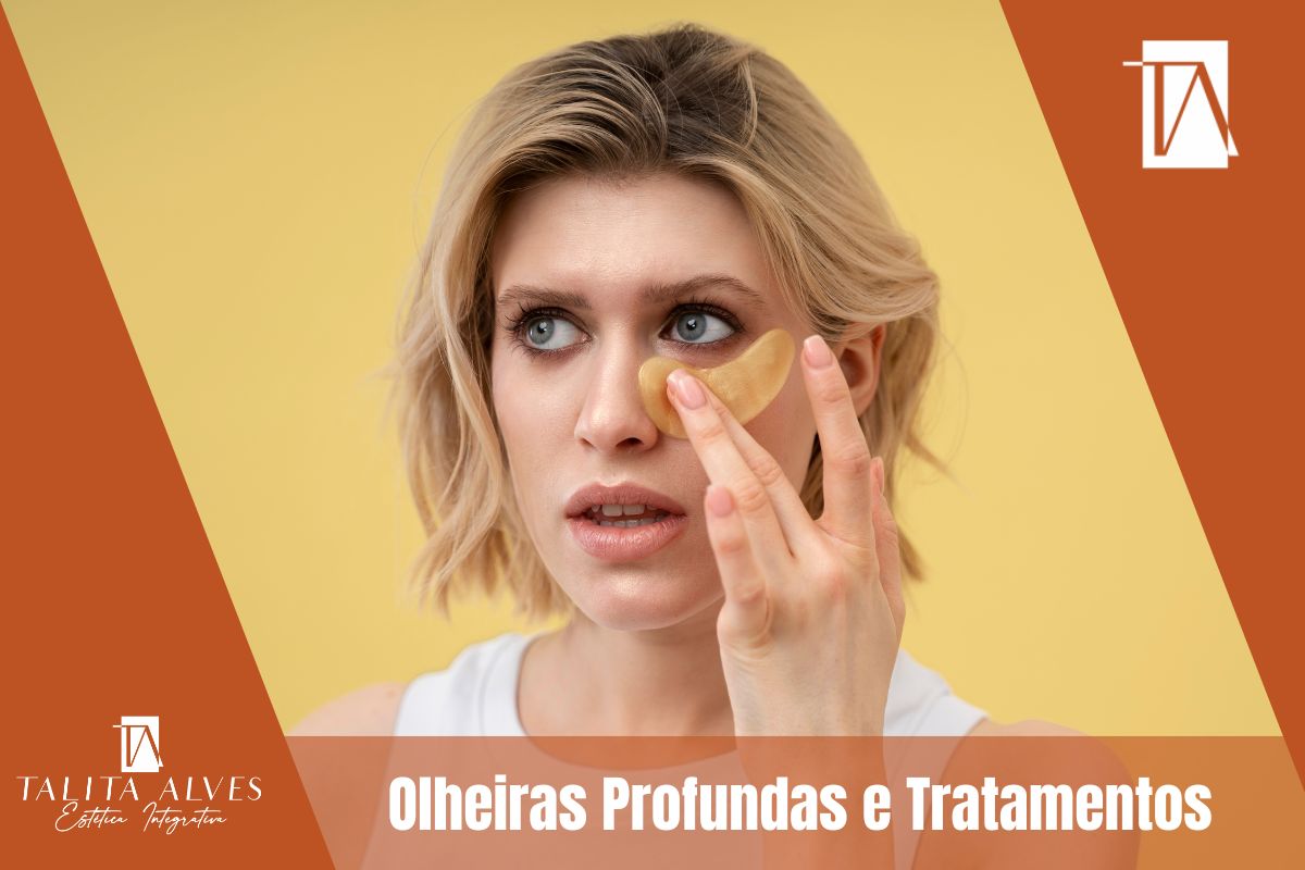Olheiras Profundas Tratamento em SP