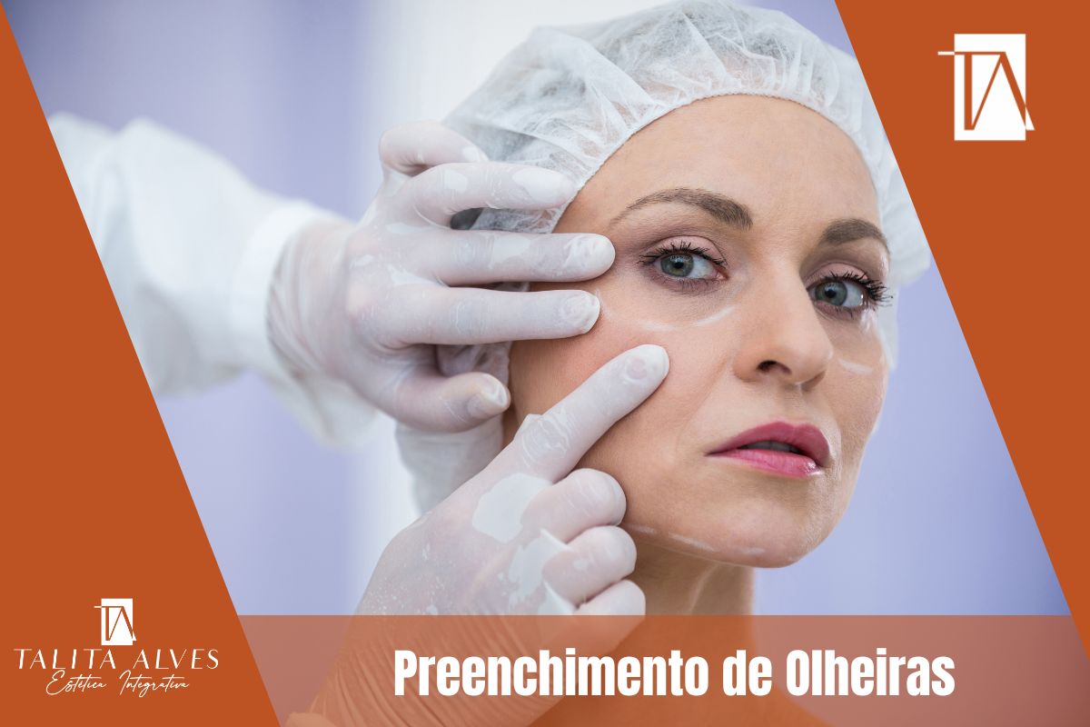 Preenchimento de Olheiras SP