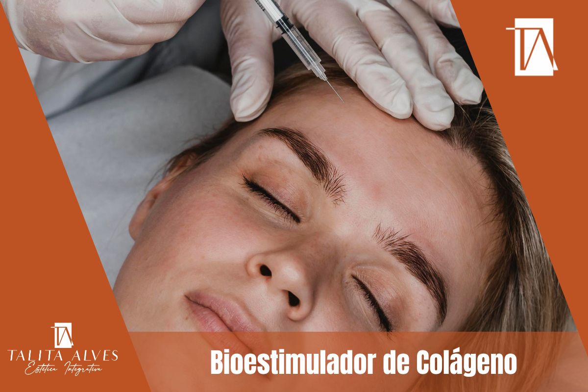 Bioestimulador de Colágeno SP