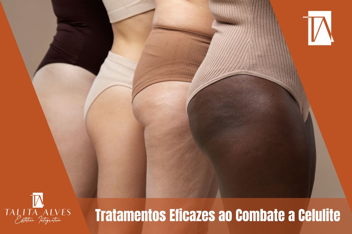 Celulite Tratamento SP