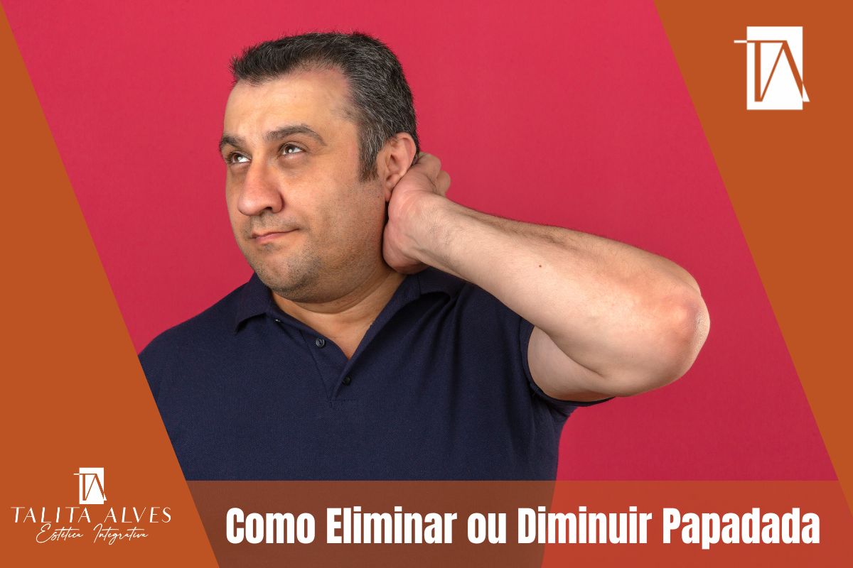 Como Eliminar ou Diminuir Papadada em SP