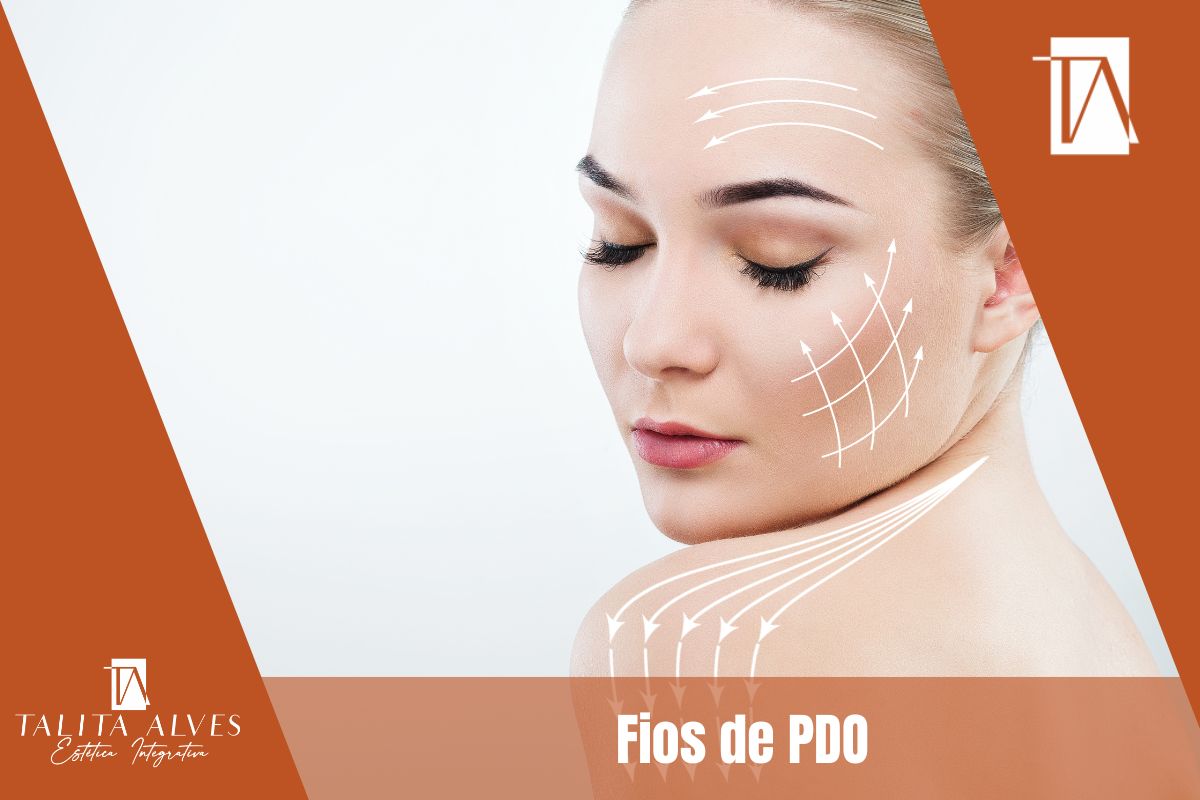 Fios de PDO SP