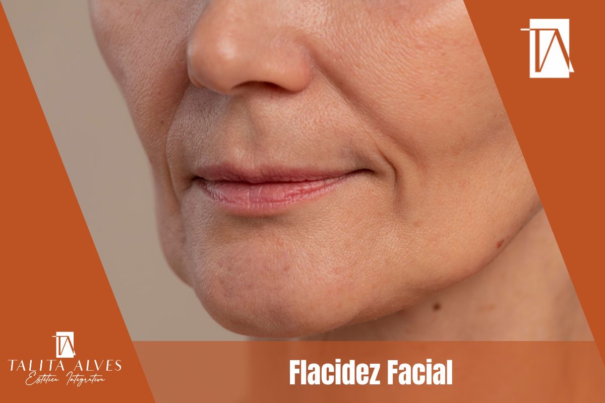 Flacidez Facial Tratamento em SP
