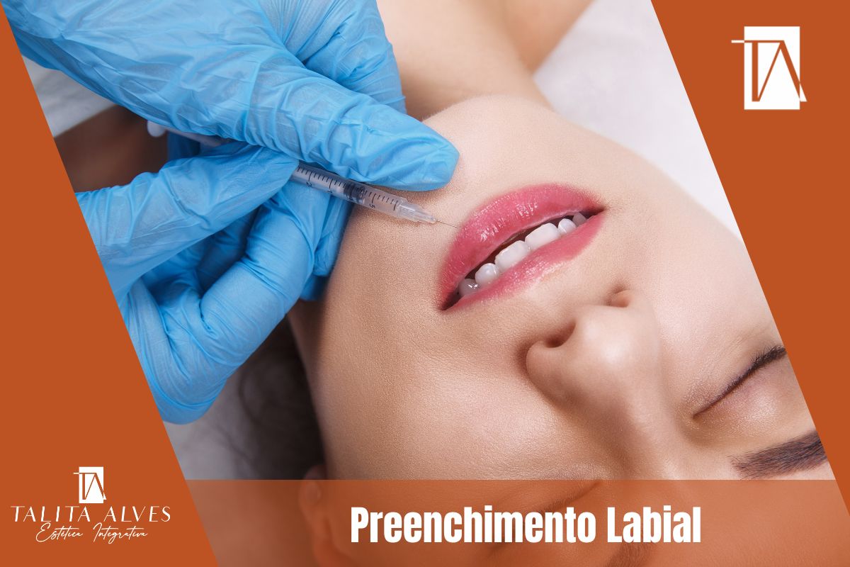 Preenchimento Labial em SP