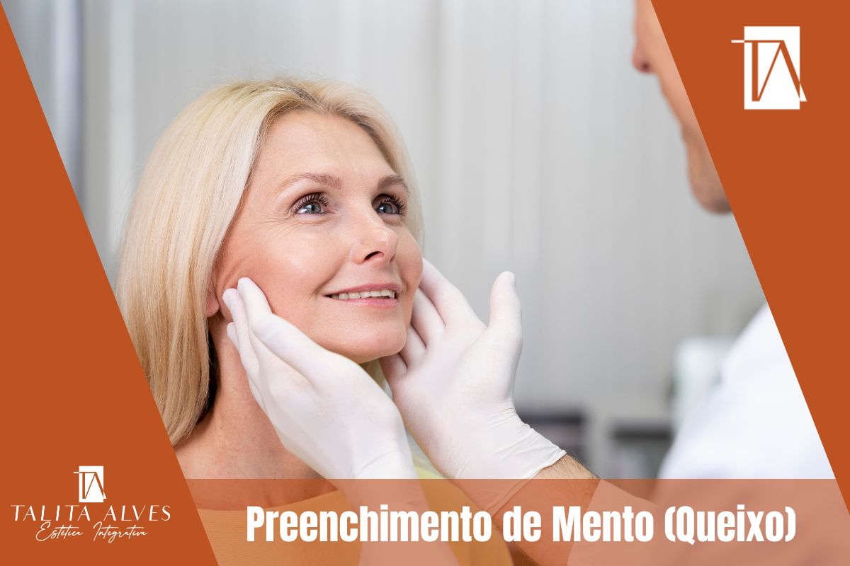 Preenchimento de Mento (Queixo) 