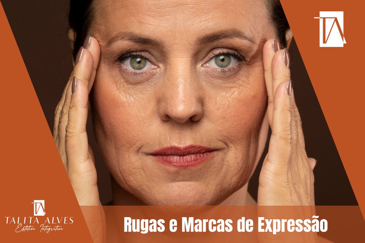 Rugas e Marcas de Expressão