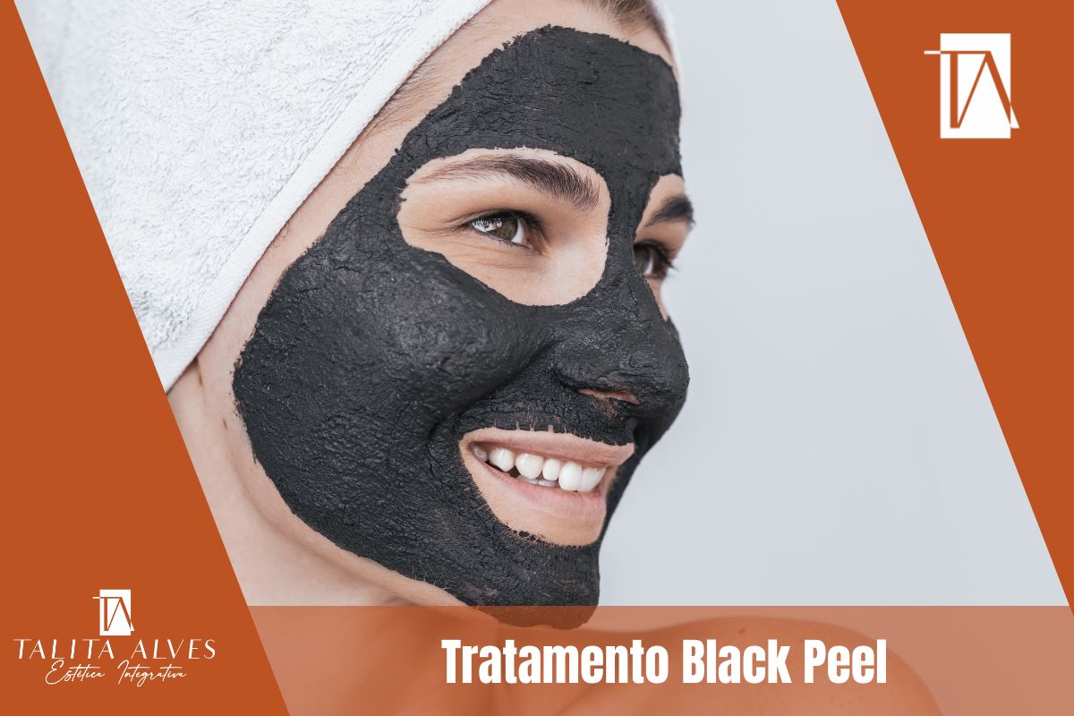 Tratamento Black Peel SP