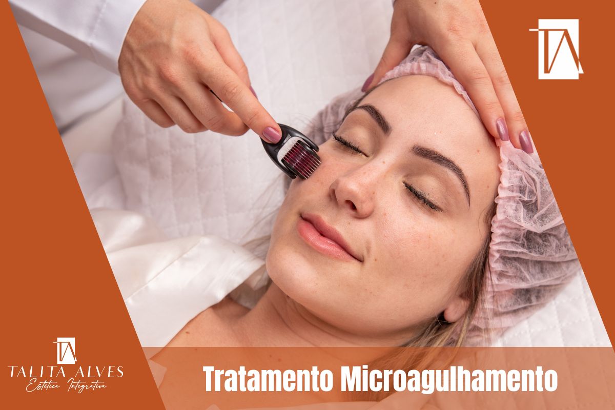 Tratamento Microagulhamento SP