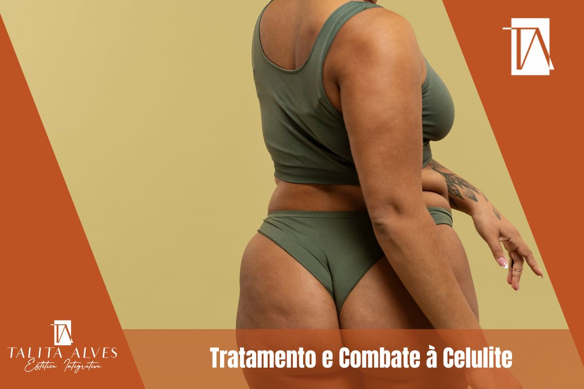 Celulite Tratamento ao lado do metrô São Judas