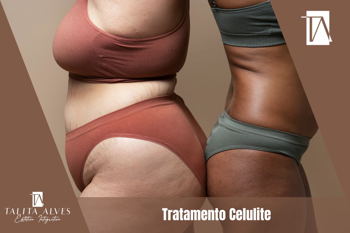 Clinica de Estética Corporal Tratamento Celulite