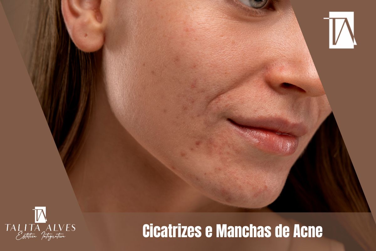 Clinica de Estética Corporal Cicatrizes e Manchas