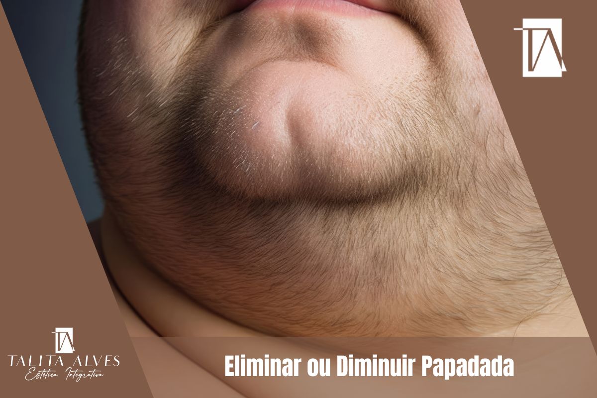 Clinica de Estética Facial Eliminar ou Diminuir Papadada