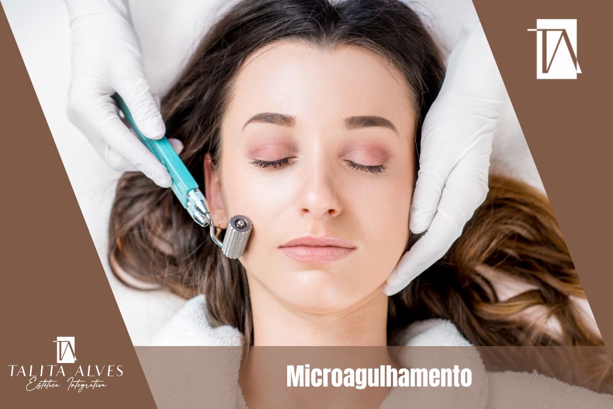 Clinica de Estética Facial Microagulhamento
