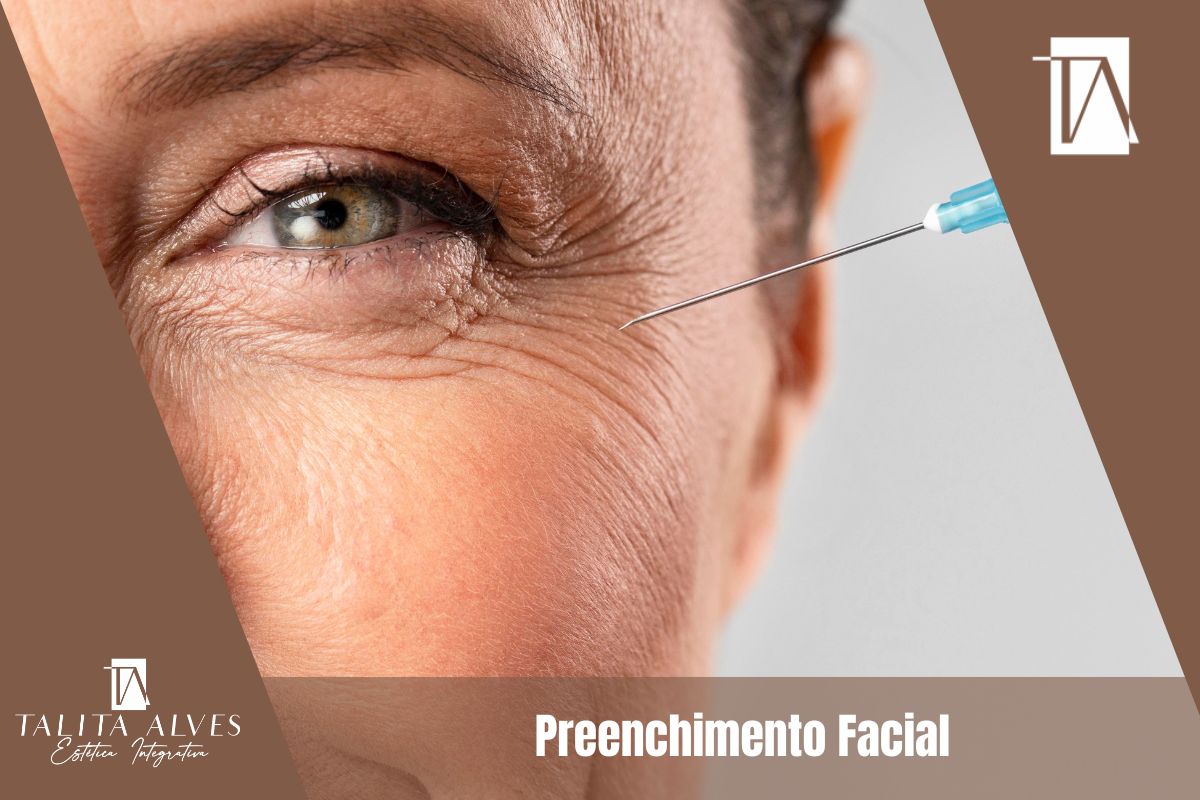Clinica de Estética Facial Preenchimento Facial