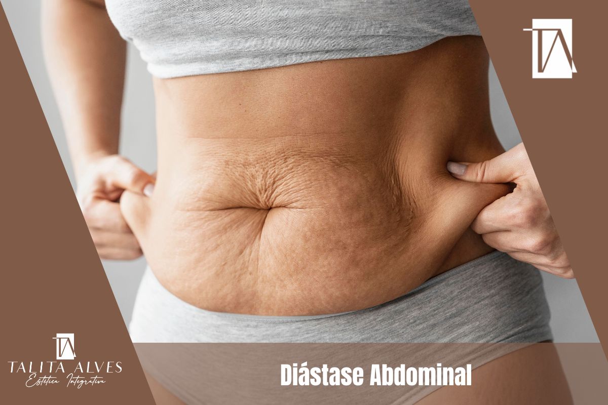 Diástase Abdominal ao lado do Metrô São Judas