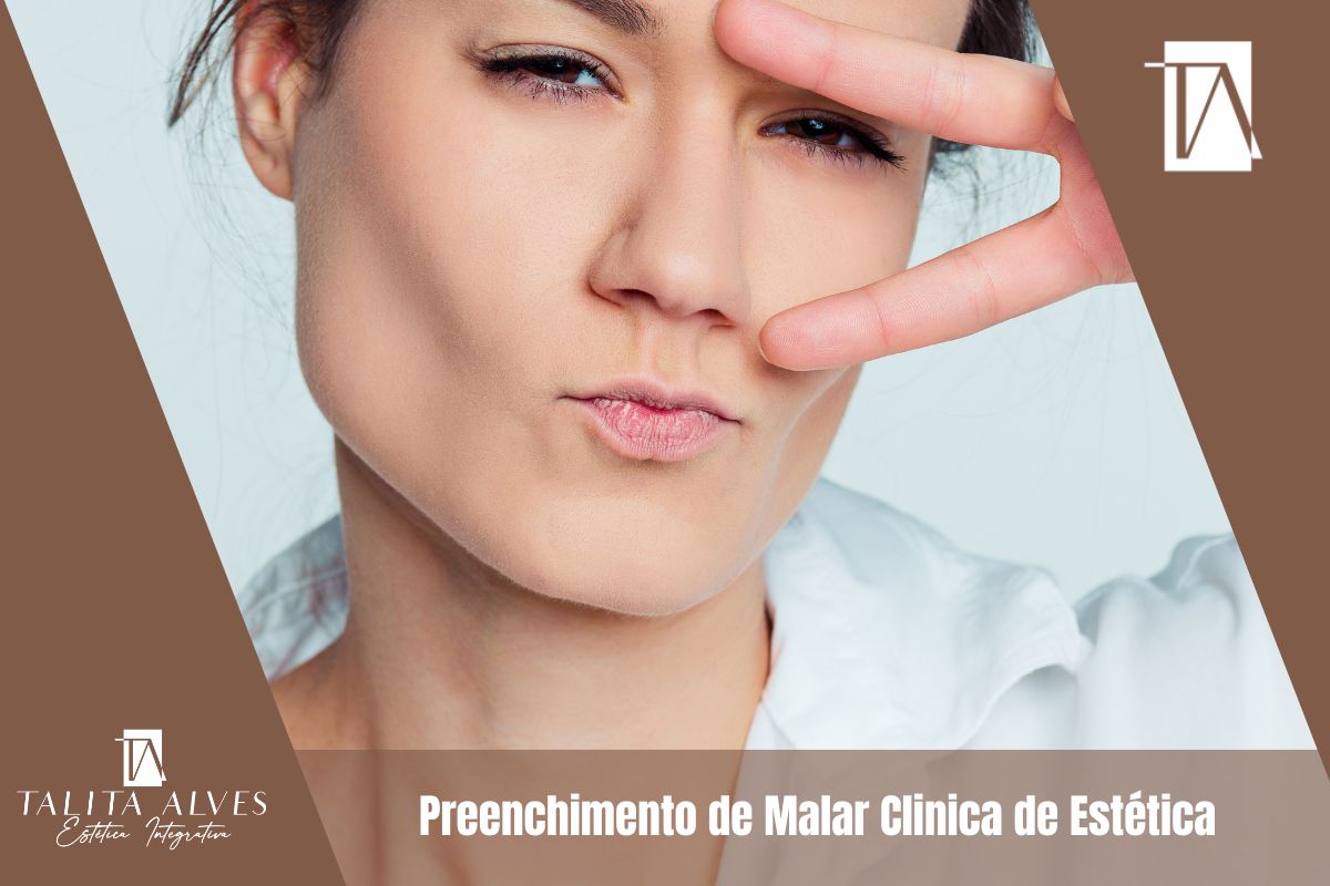 Preenchimento de Malar Clinica de Estética