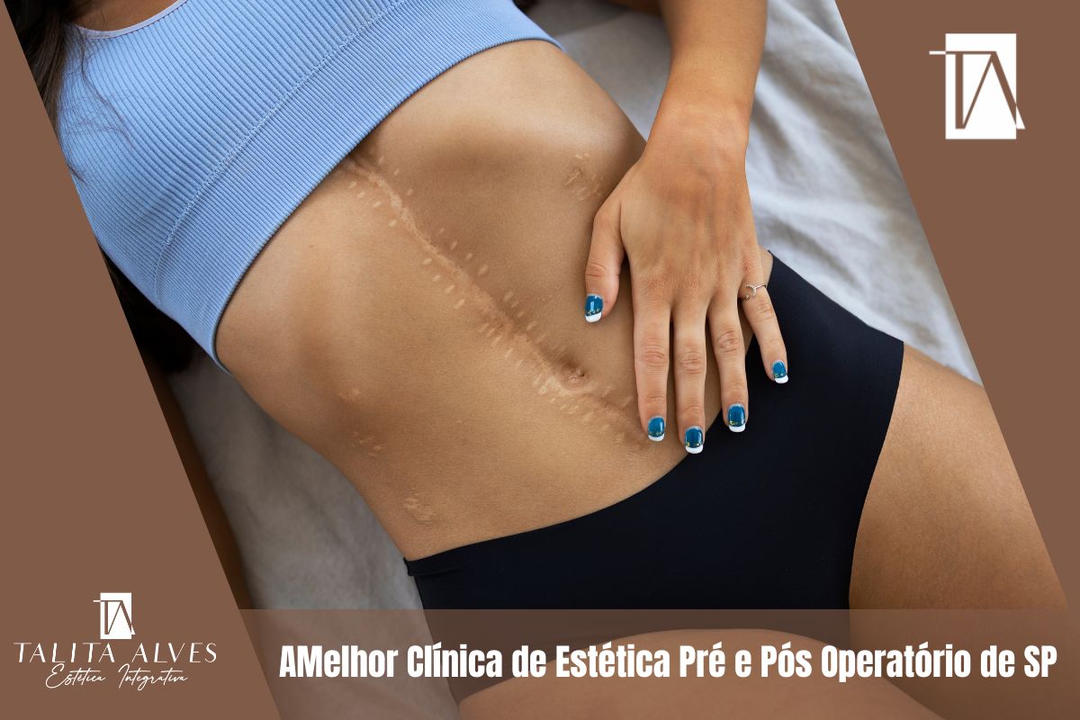 Qual a Melhor Clínica de Estética Pré e Pós Operatório de SP