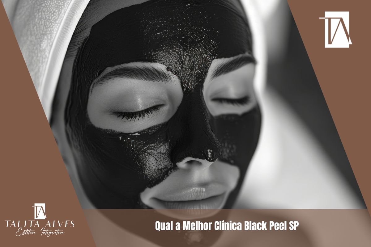 Qual a Melhor Clínica Black Peel SP