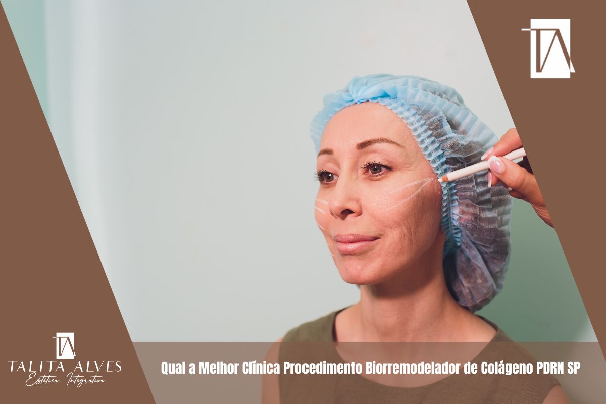 Qual a Melhor Clínica Procedimento Biorremodelador de Colágeno PDRN SP