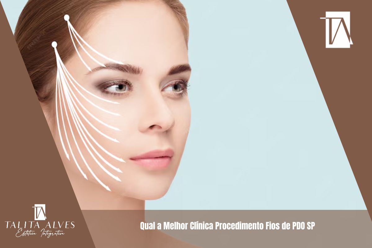 Qual a Melhor Clínica Procedimento Fios de PDO SP