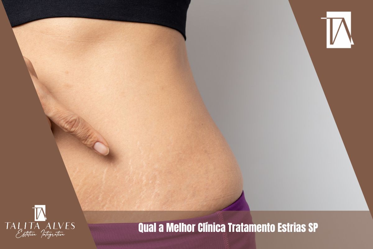 Qual a Melhor Clínica Tratamento Estrias SP