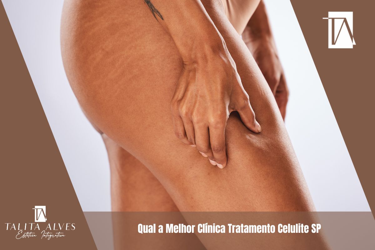 Qual a Melhor Clínica Tratamento Celulite SP
