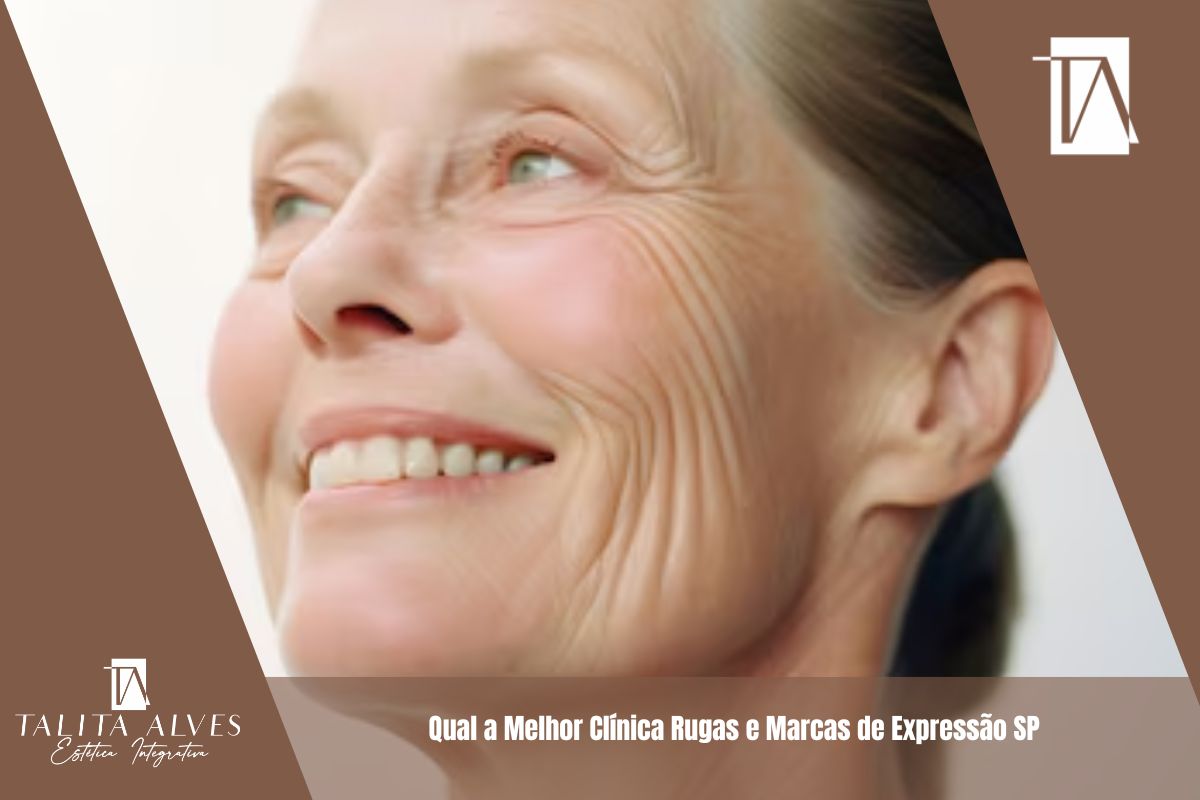 Qual a Melhor Clínica Rugas e Marcas de Expressão SP