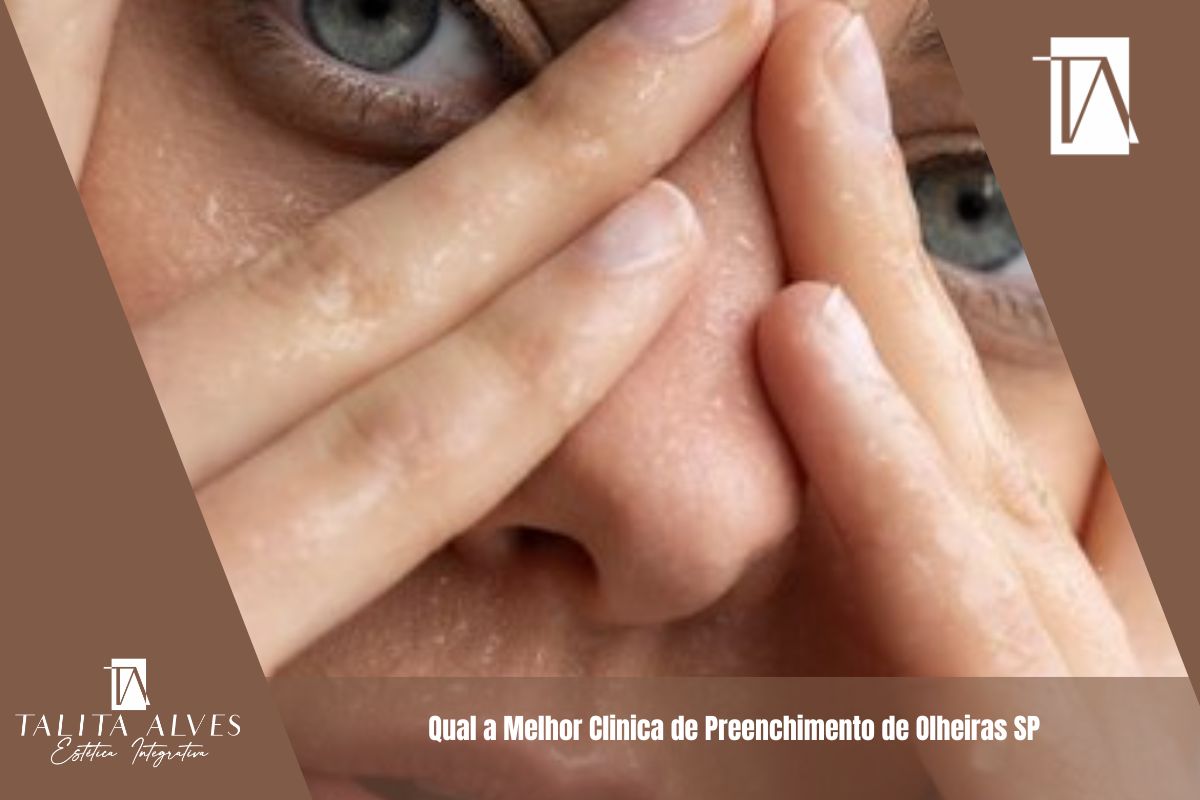 Qual a Melhor Clinica de Preenchimento de Olheiras SP