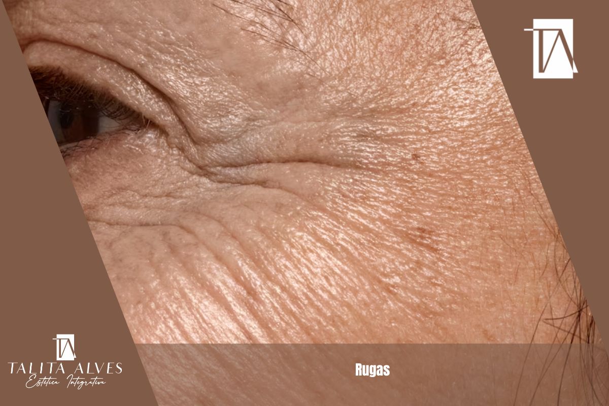 Rugas