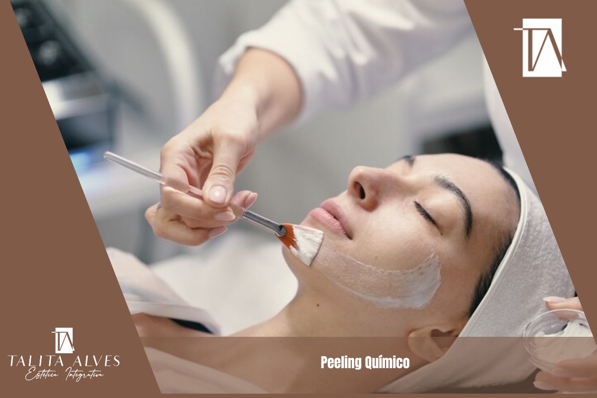Peeling Químico