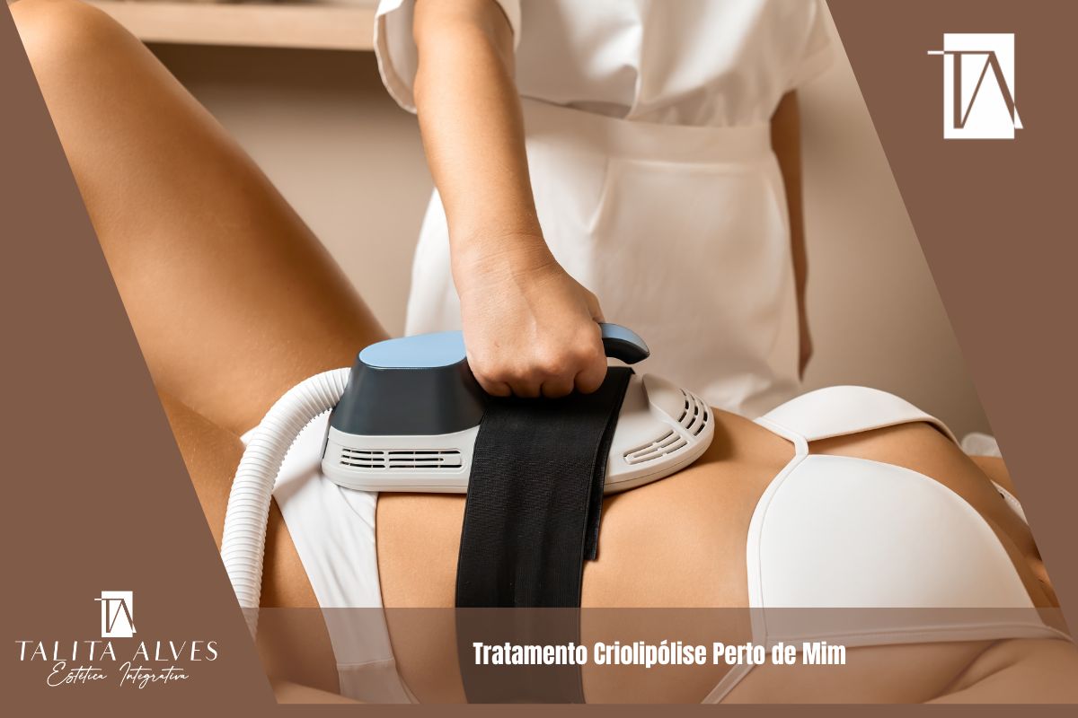 Tratamento Criolipólise Perto de Mim