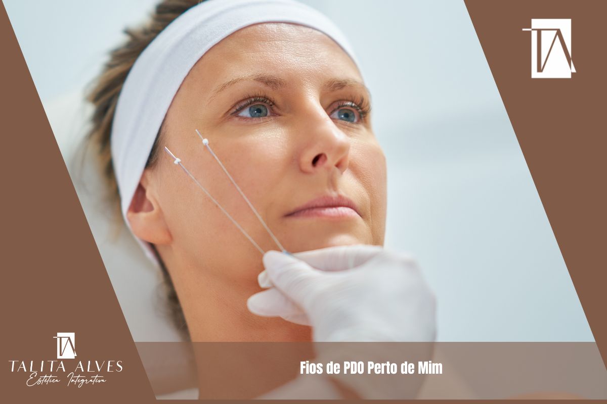 Fios de PDO Perto de Mim