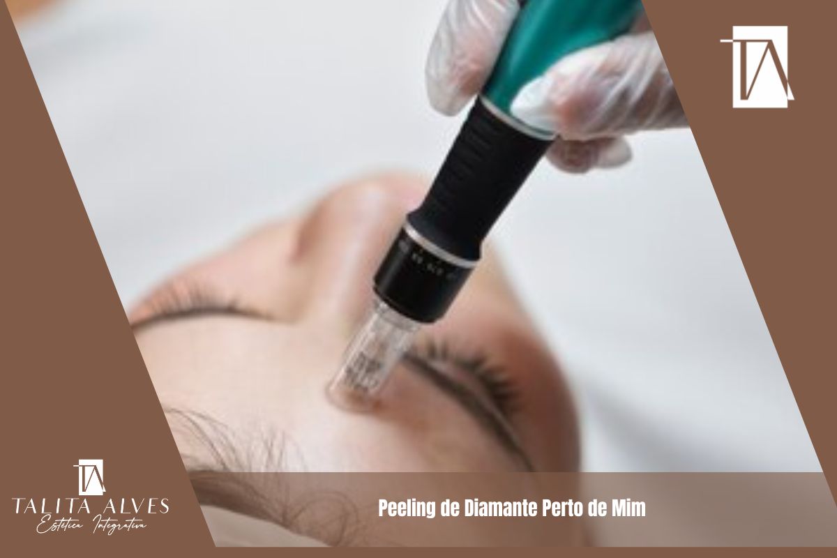 Peeling de Diamante Perto de Mim