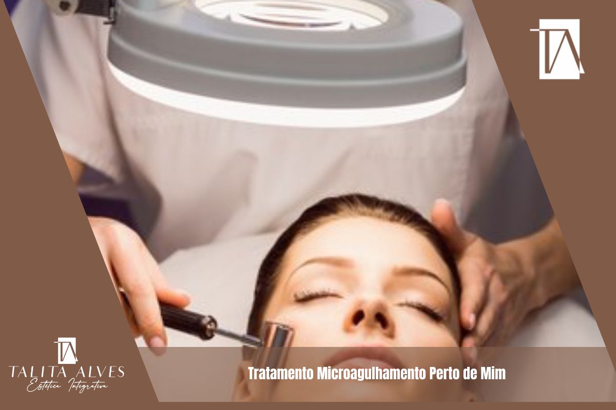 Tratamento Microagulhamento Perto de Mim