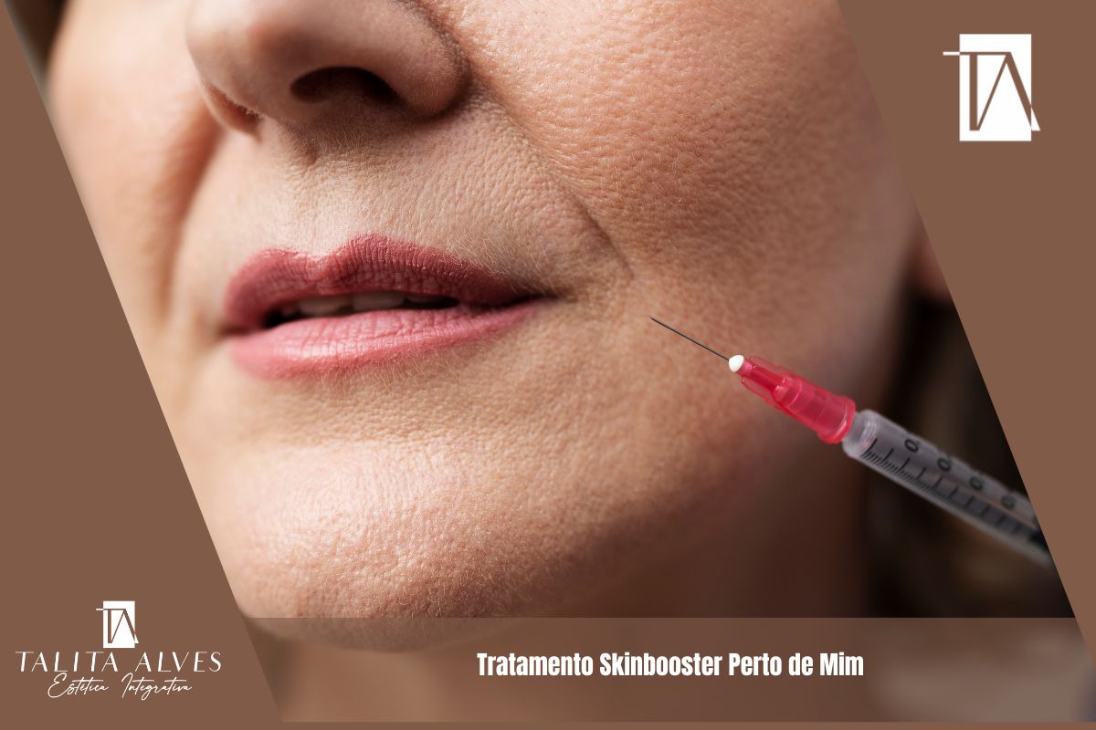 Tratamento Skinbooster Perto de Mim