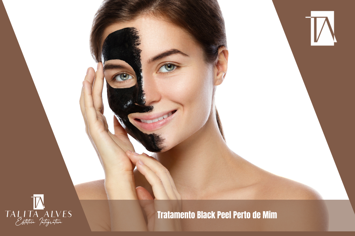 Tratamento Black Peel Perto de Mim