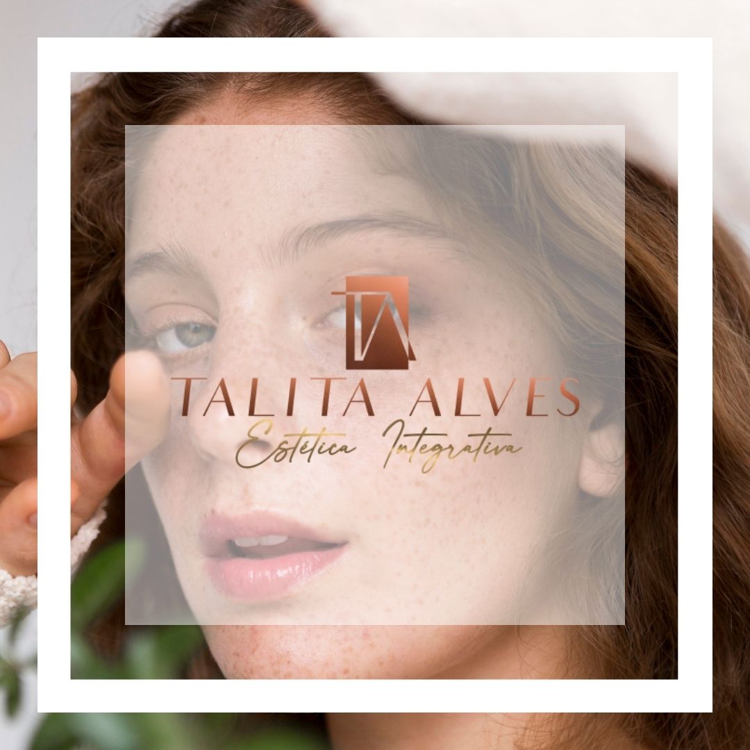 Tratamento Manchas e Melasma em SP