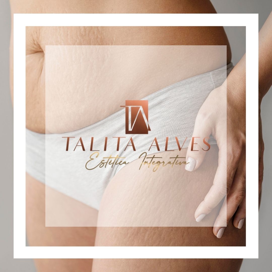 Celulite Tratamento SP