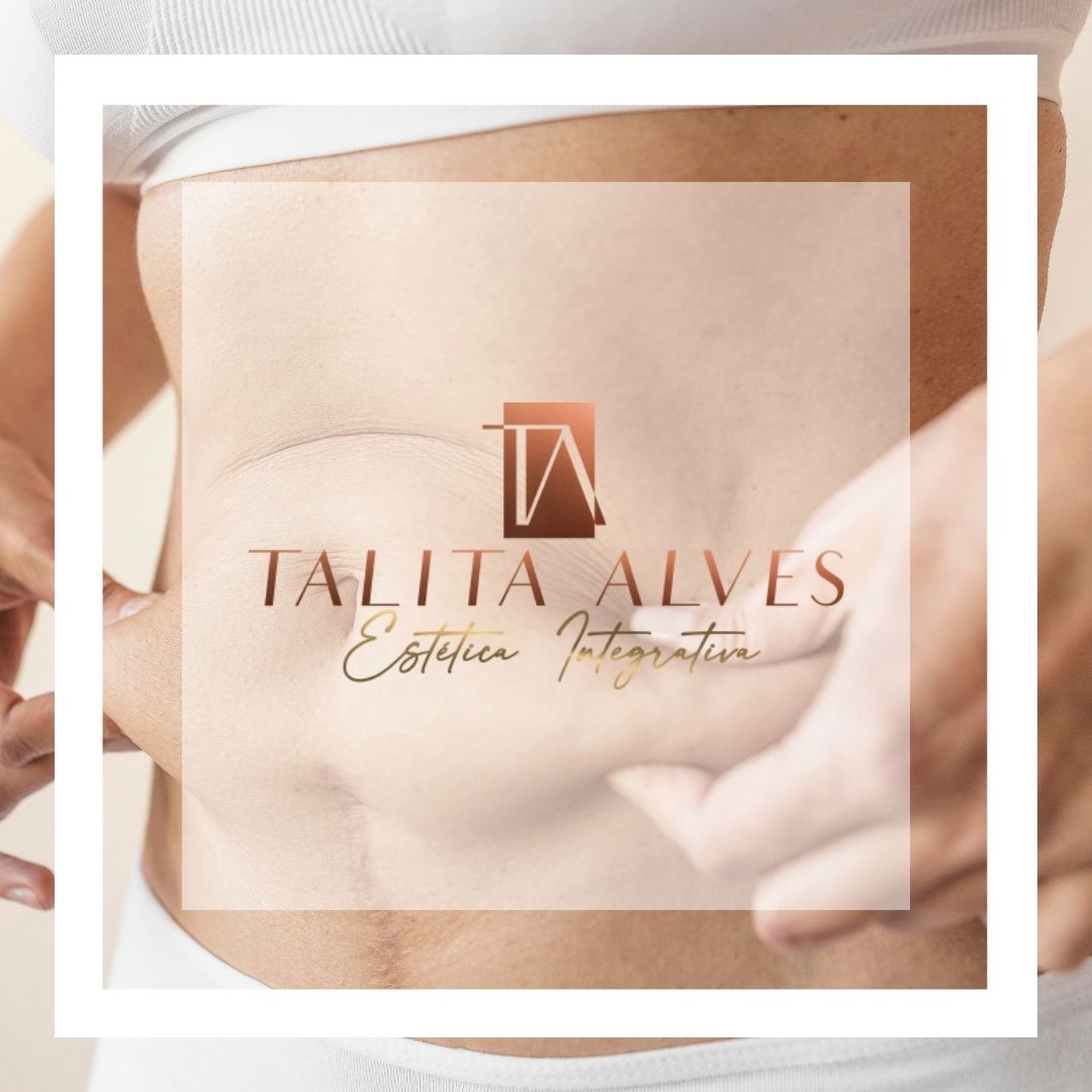 Emagrecer Perder Barriga Procedimentos Estéticos SP