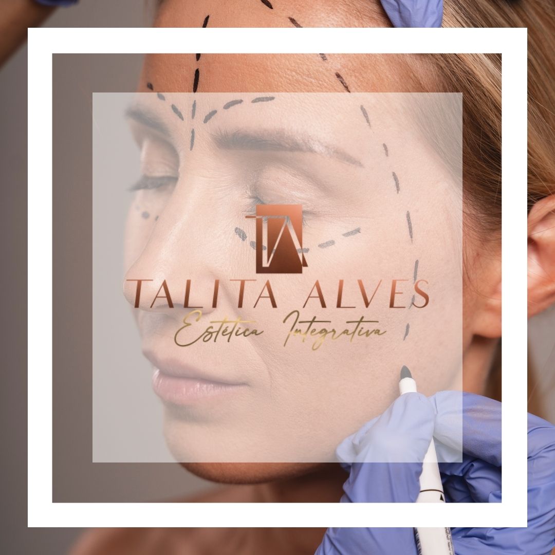 Fios de Silhouette SP