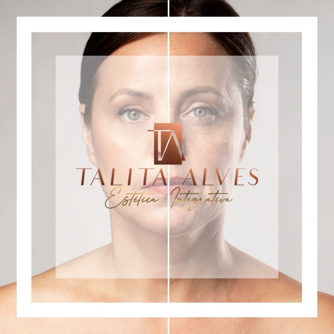 Flacidez Facial Tratamento em SP