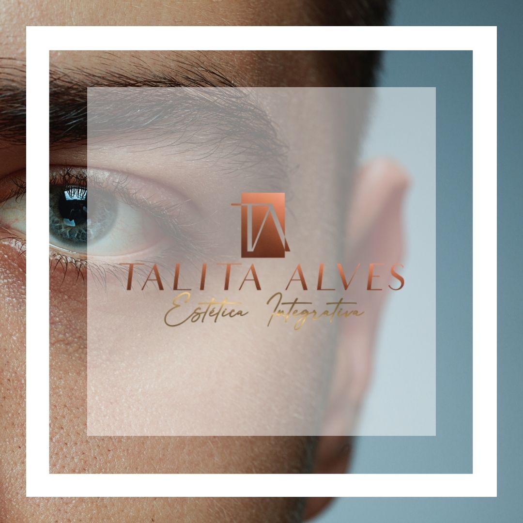 Olheiras Profundas Tratamento em SP