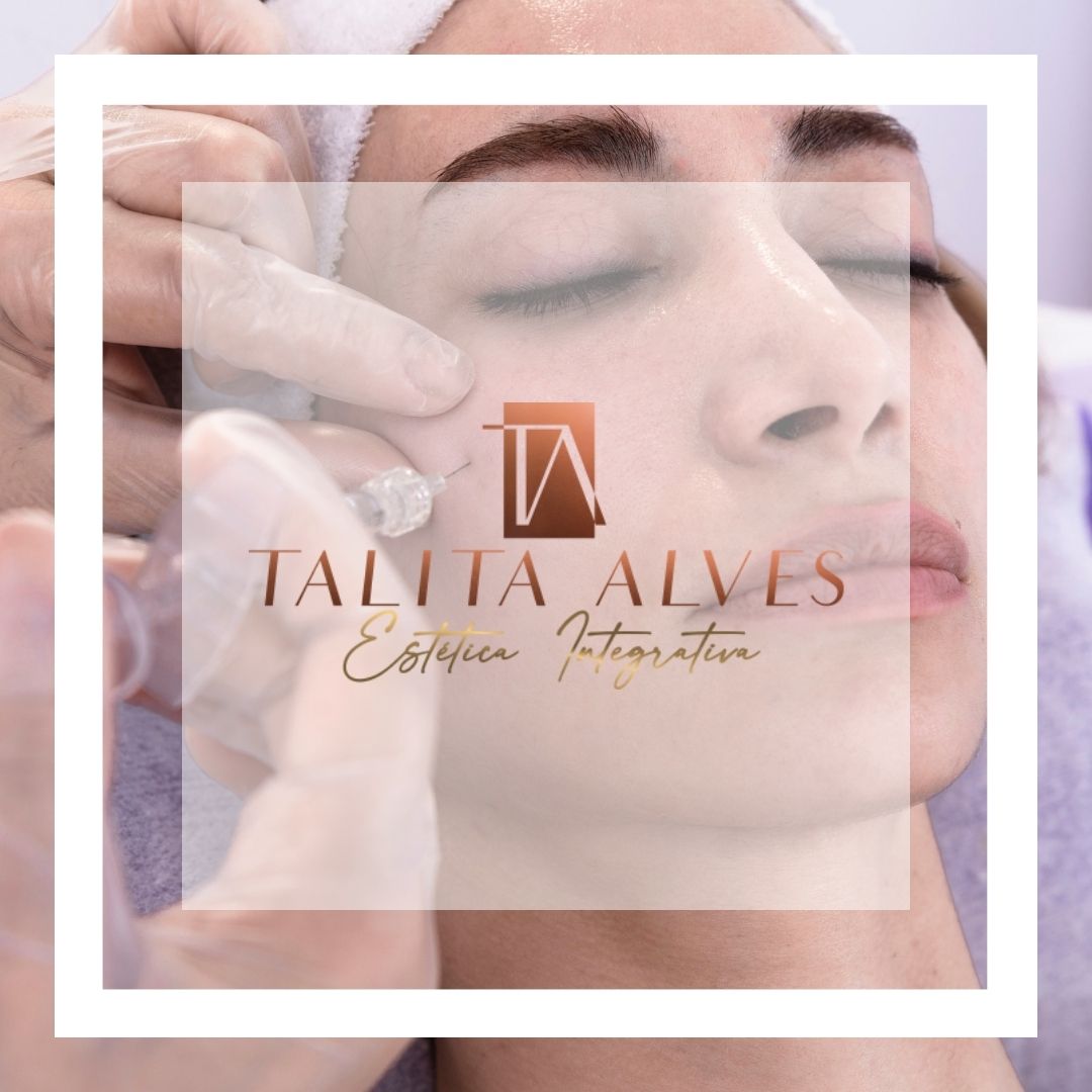 Preenchimento de Malar em SP