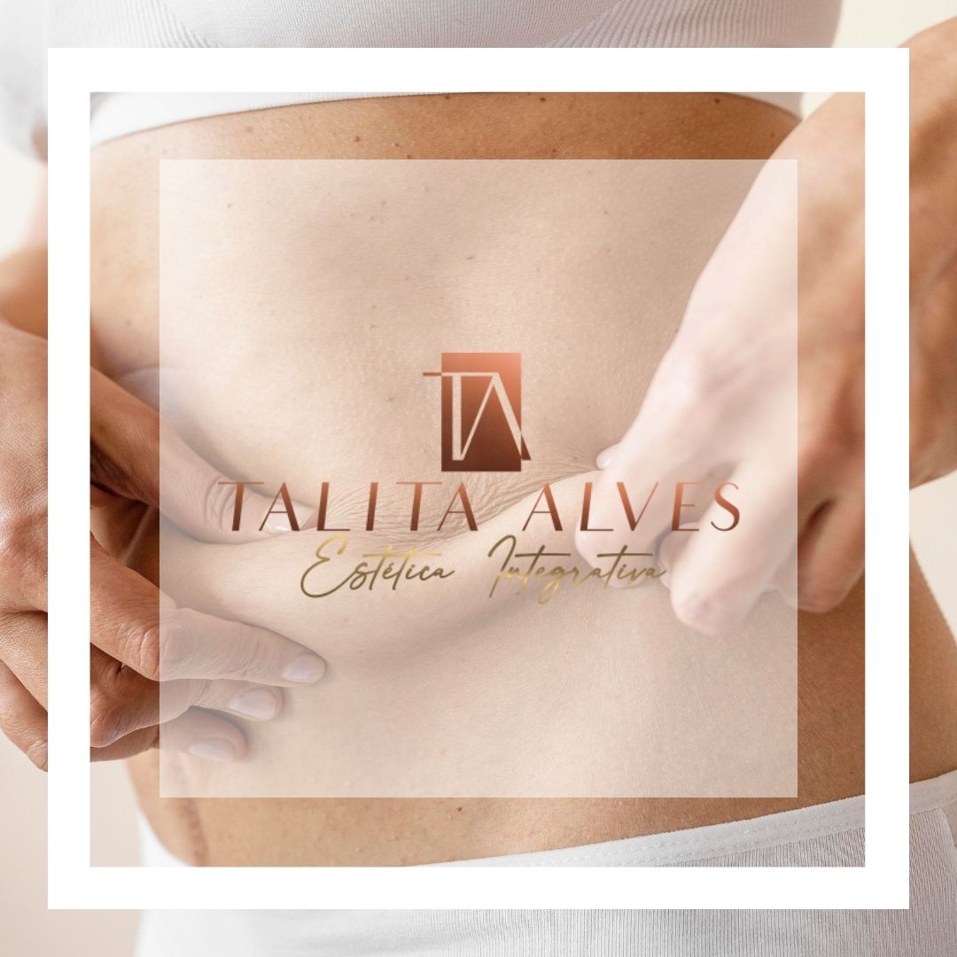 Tratamento para Gordura Localizada SP