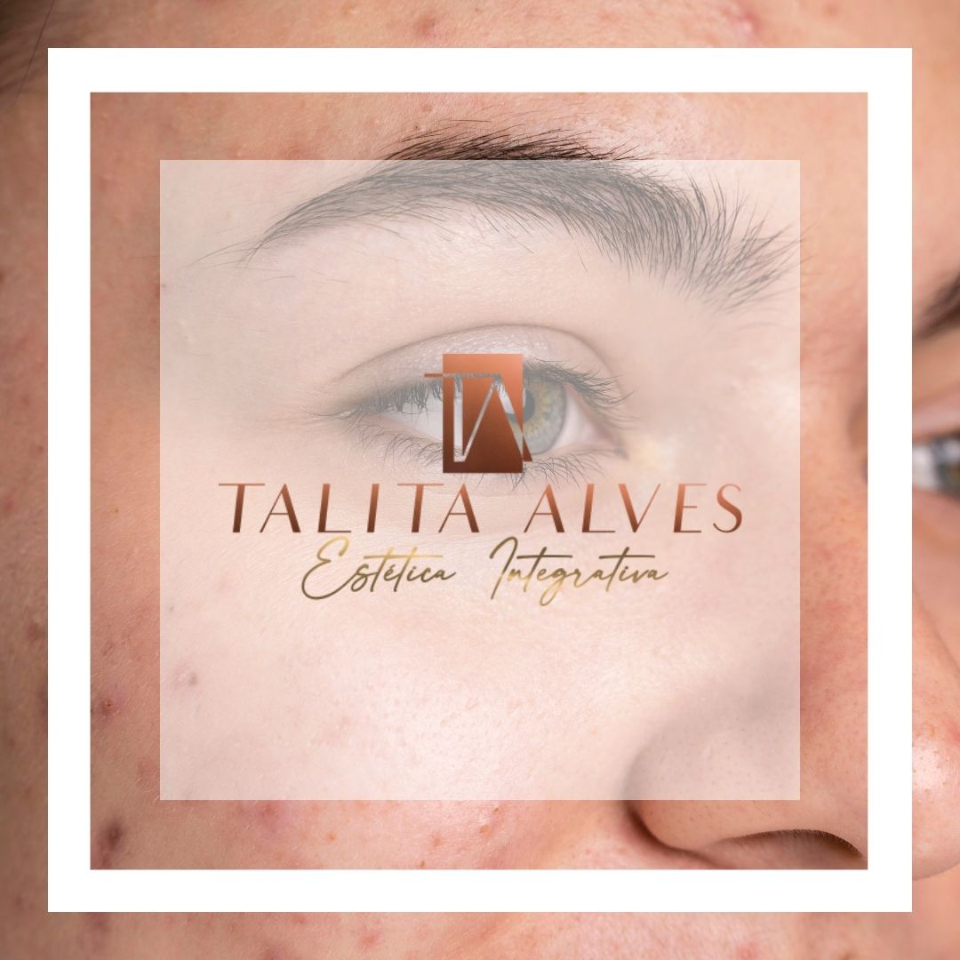 Tratamento Manchas e Melasma ao Lado do Metrô São Judas