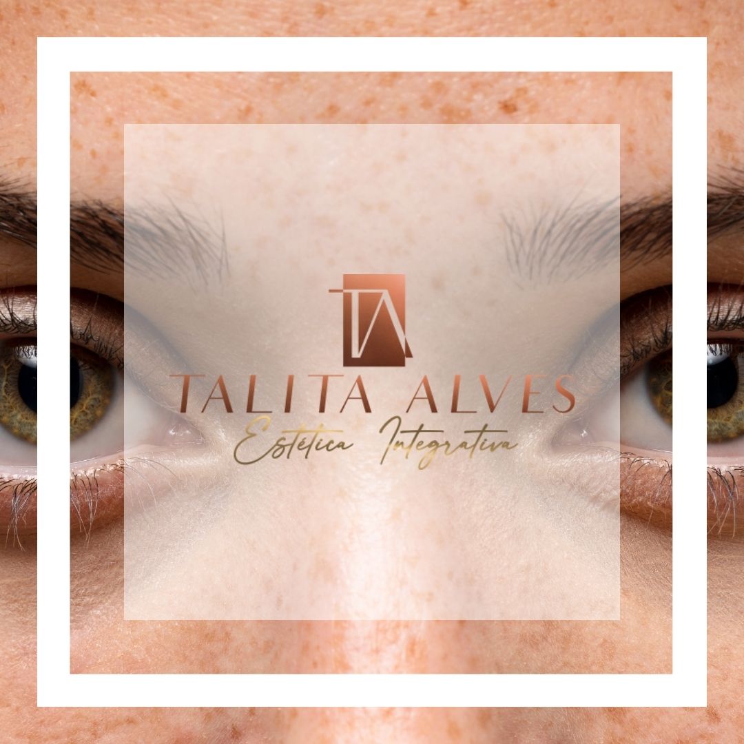 Tratamento Olheiras Profundas ao Lado do Metrô São Judas