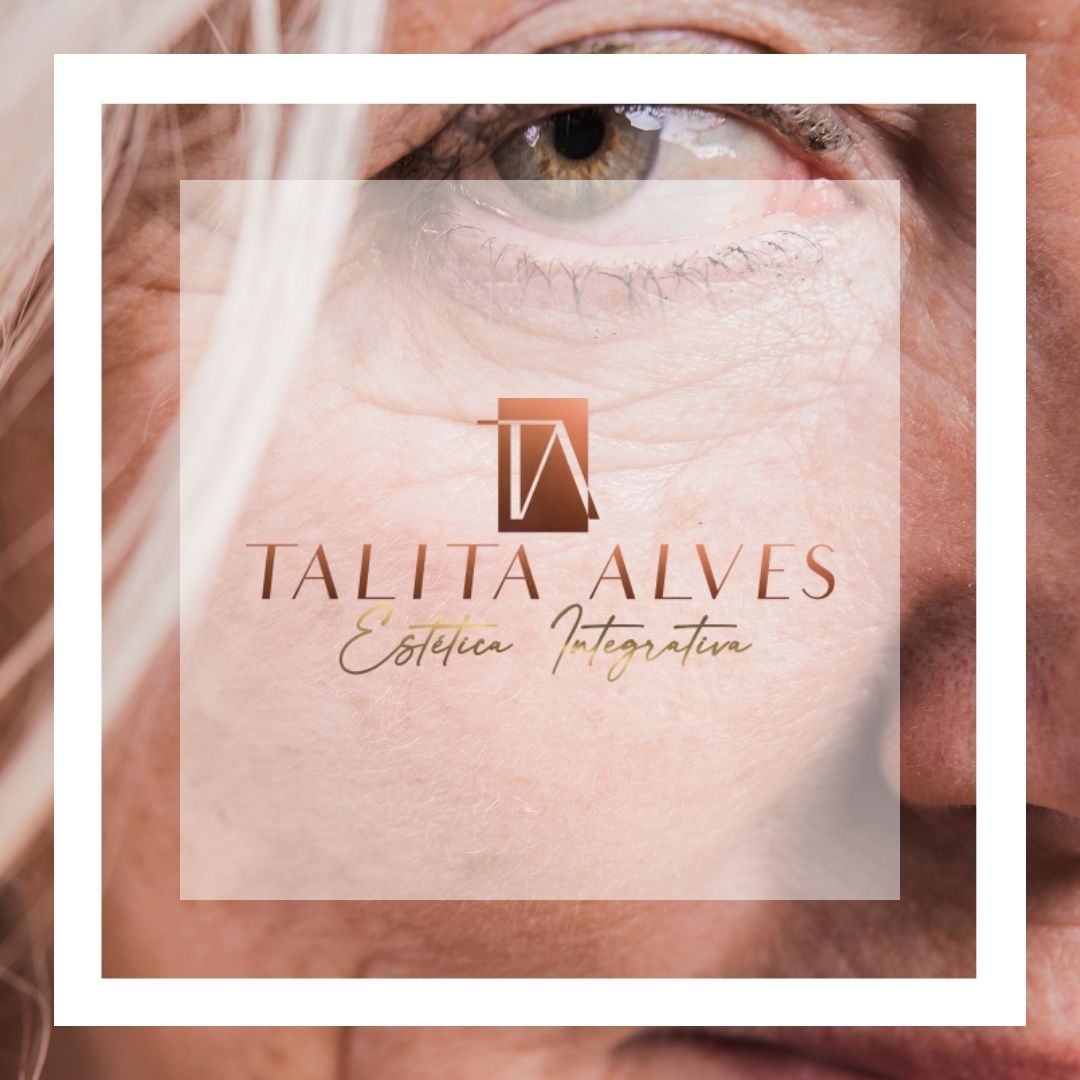 Tratamento Rugas e Marcas de Expressão ao Lado do Metrô