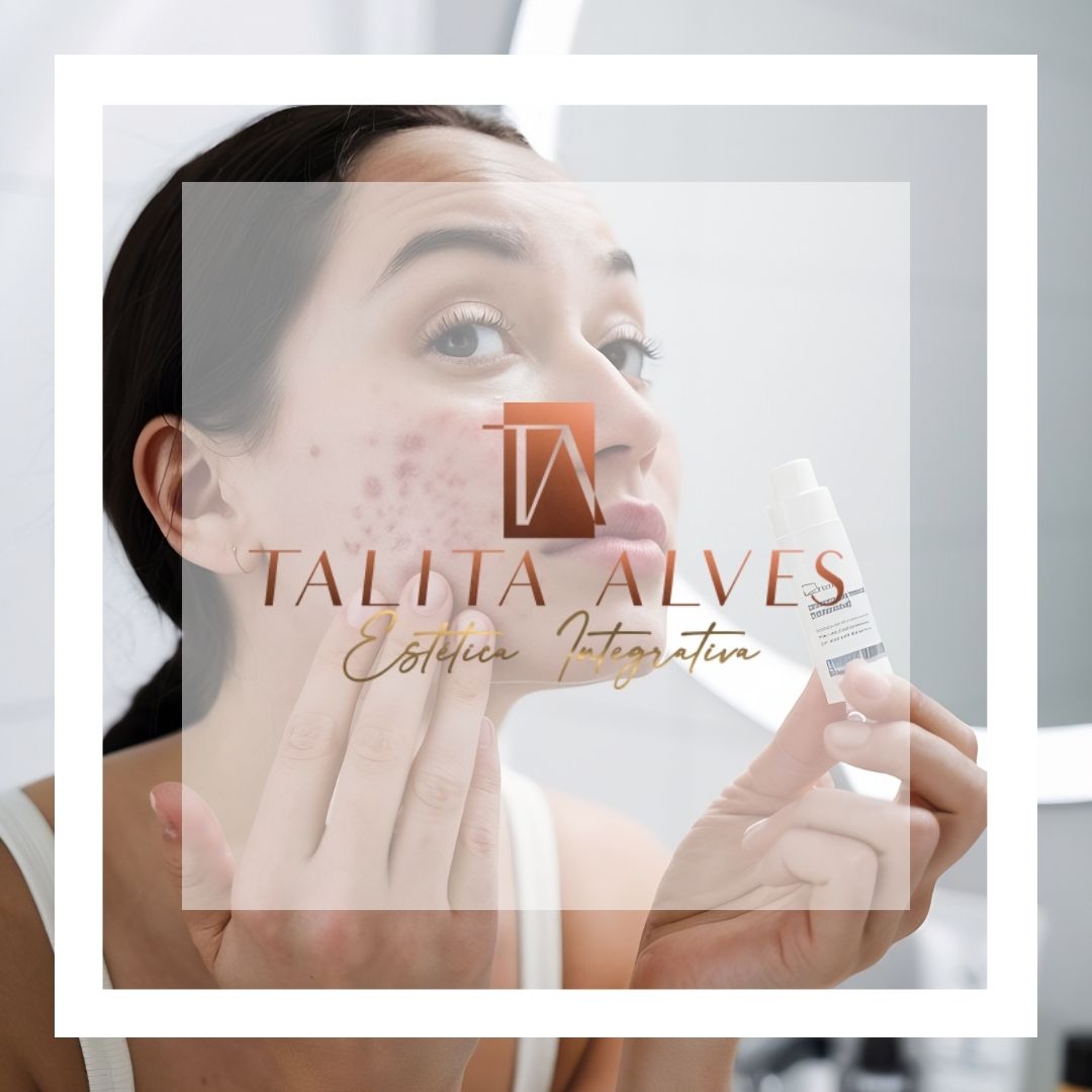 Clinica de Estética Facial Tratamento Cicatrizes Manchas de ACNE