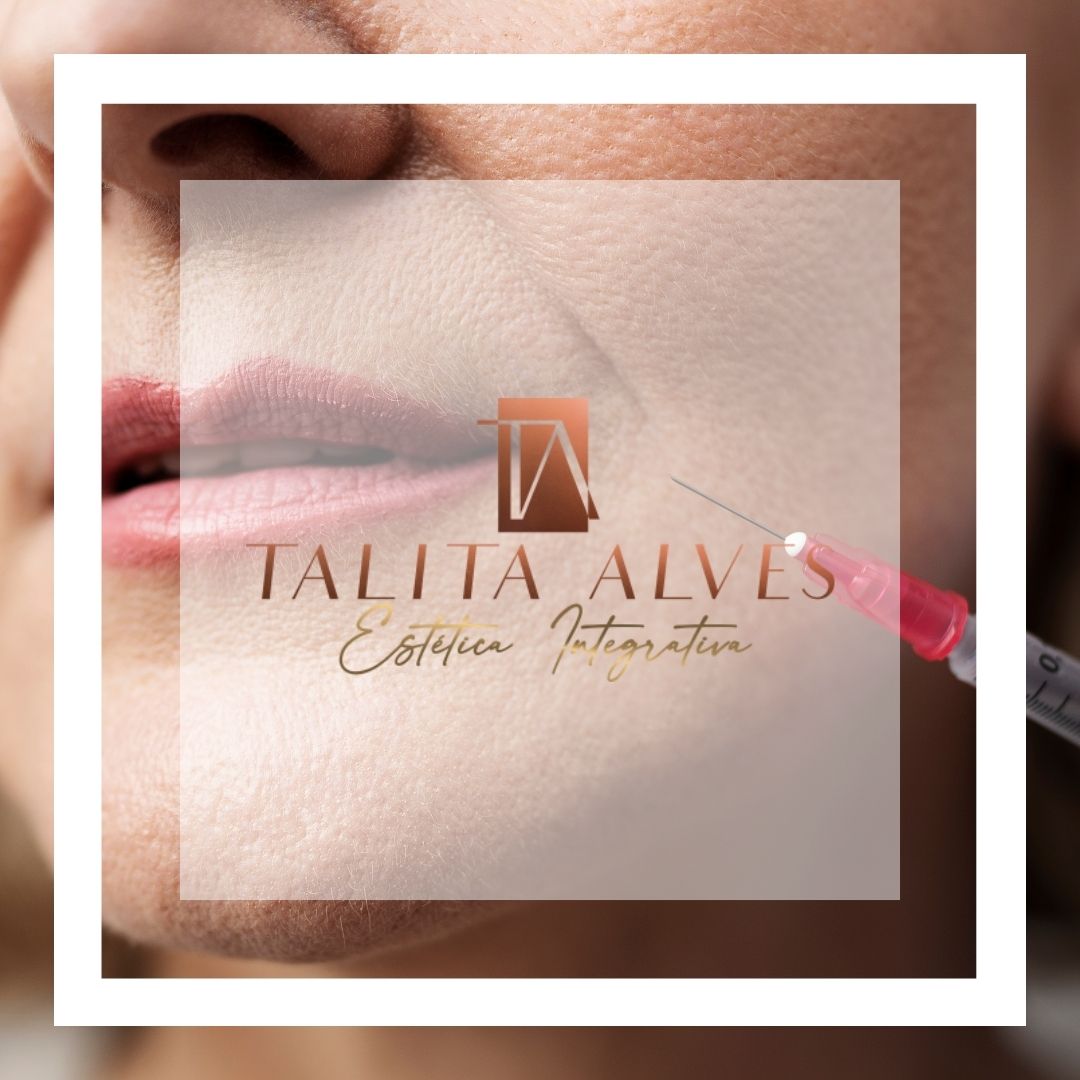 Clinica de Estética Procedimento Preenchimento Bigode Chinês
